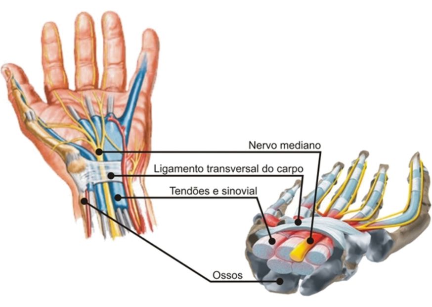 uma mão vista de forma interna para demonstrar o que acontece quando se desenvolve túnel do carpo